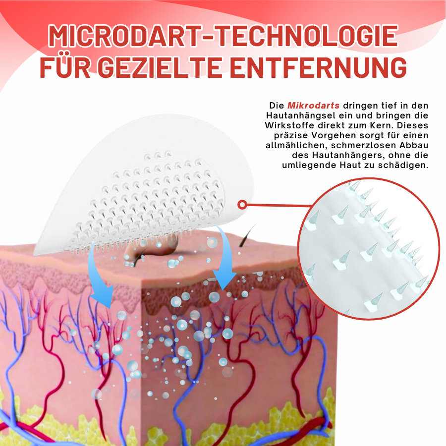Fivfivgo® MicroDart Haut Tag Entferner Patch