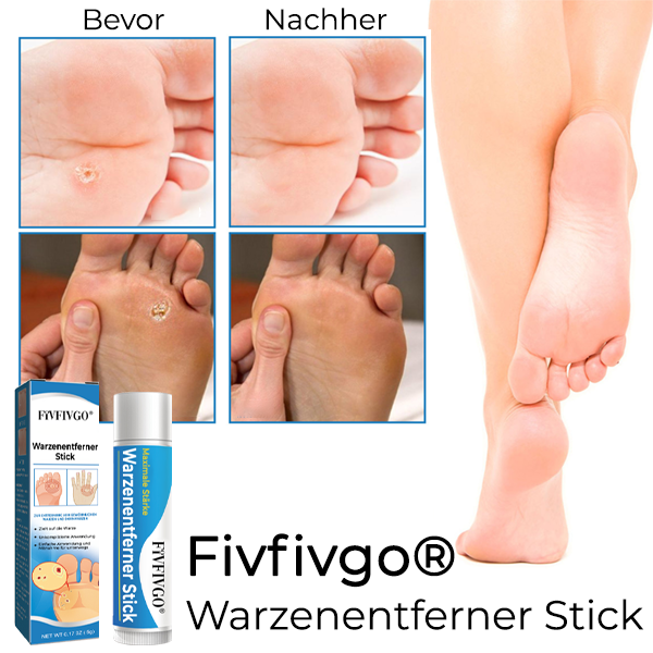 Fivfivgo® Warzenentferner Stick