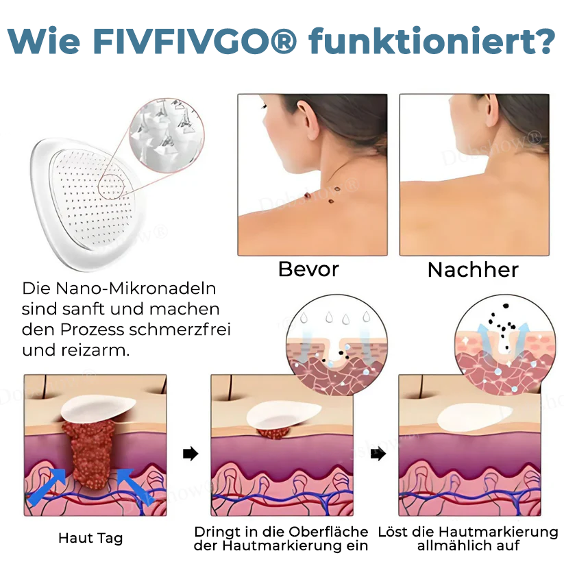 Fivfivgo® Pro TagsGone Multi-Muster-Aufnäher
