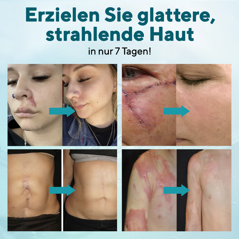 Fivfivgo® Erweiterte Narbengel