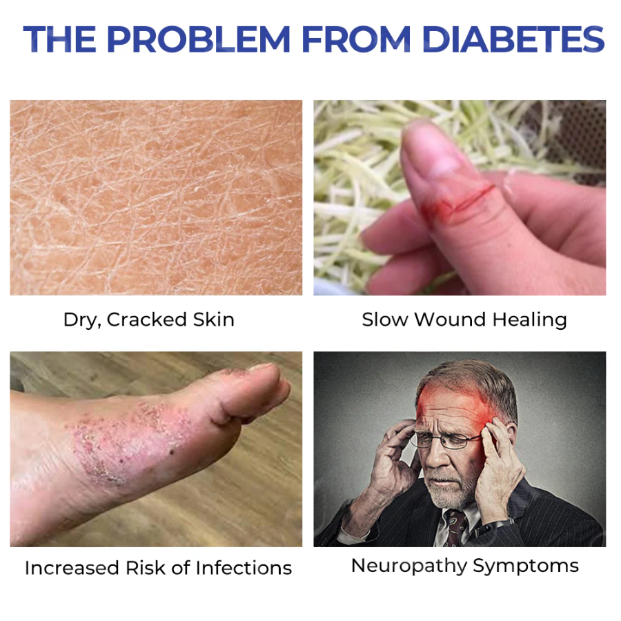 Fivfivgo™ DiaRelief Feuchtigkeitscreme (Spezialisiert für Diabetiker)