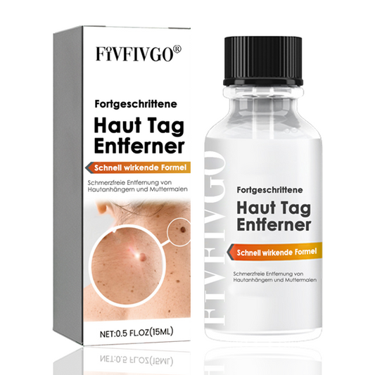 Fivfivgo® Fortgeschrittene Haut Tag Entferner - Schnell wirkende Formel