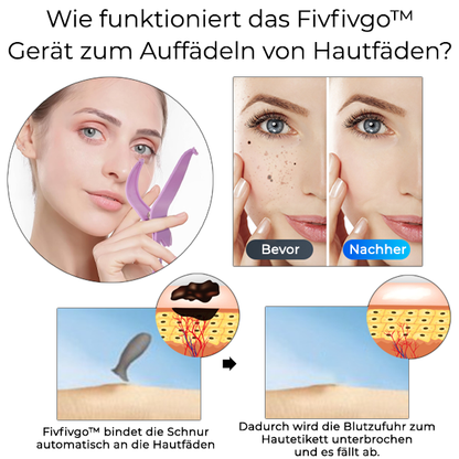 Fivfivgo™ Gerät zum Auffädeln von Hautfäden