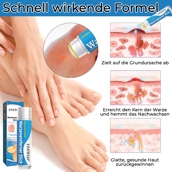 Fivfivgo® Warzenentferner Stick