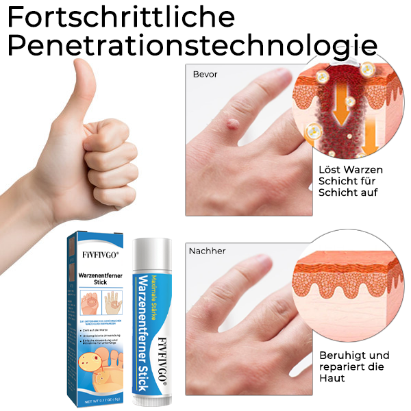 Fivfivgo® Warzenentferner Stick