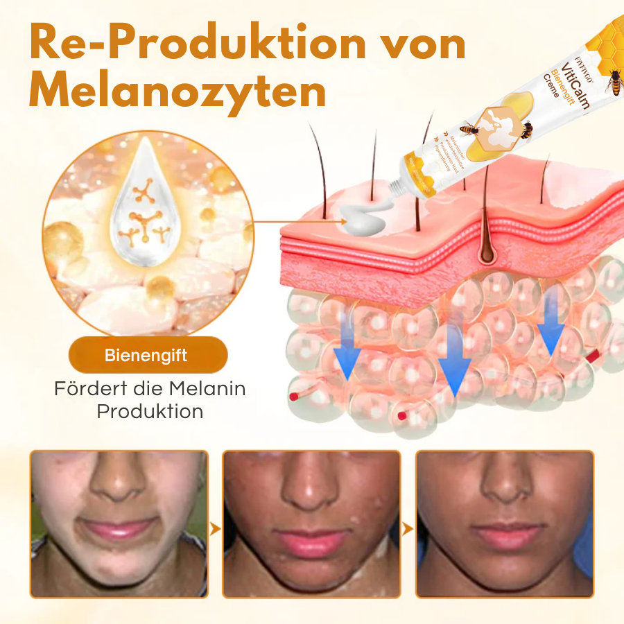 Fivfivgo® VitiCalm Bienengift-Creme