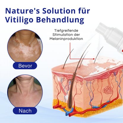 Fivfivgo® VitiClear Kräuter Spray