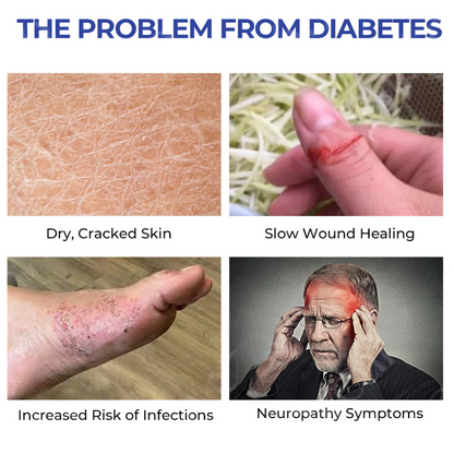 Fivfivgo™ DiaRelief Feuchtigkeitscreme (Spezialisiert für Diabetiker)