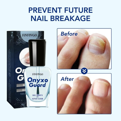 Fivfivgo™ OnyxoGuard Wachstum der Nägel und Reparaturserum