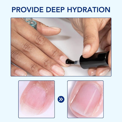 Fivfivgo™ OnyxoGuard Wachstum der Nägel und Reparaturserum